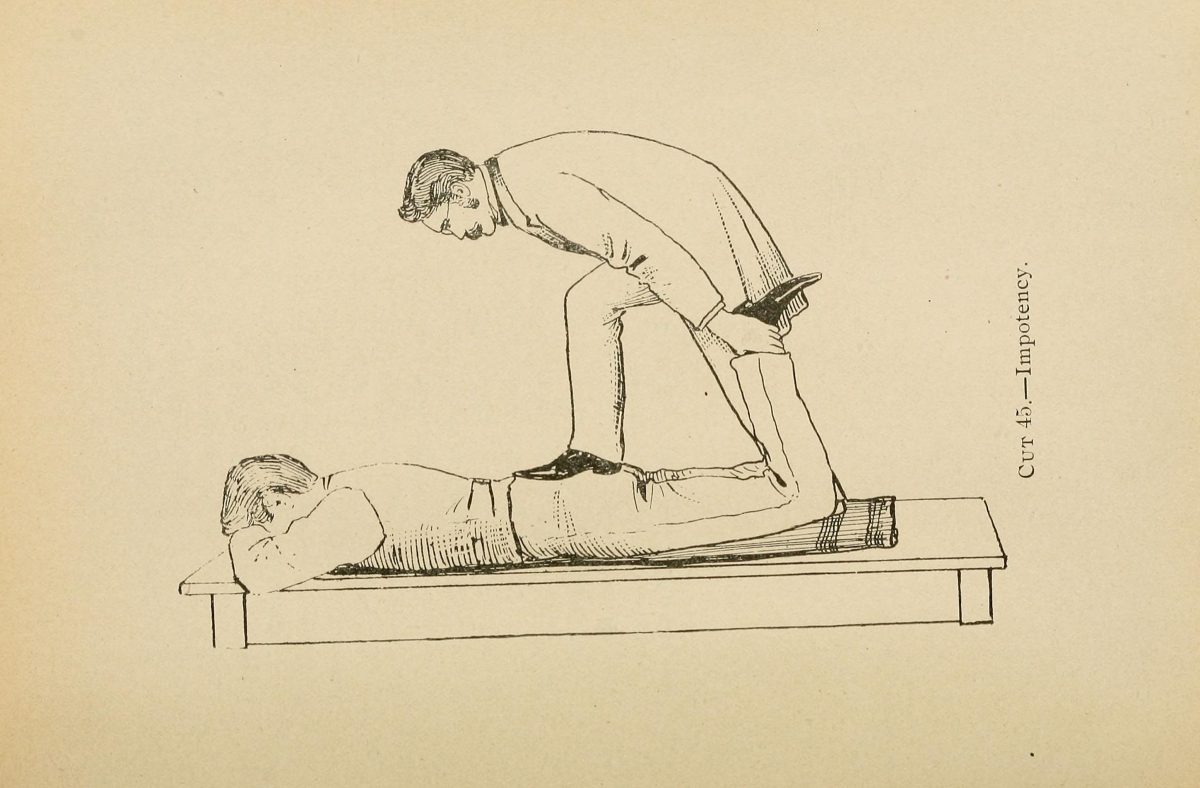 Gravure de 1898 : un homme debout, penché sur un patient allongé à plat ventre sur une table, lui appuie les mains sur le bas du dos. Légende : « Cut 45. Impotency ».