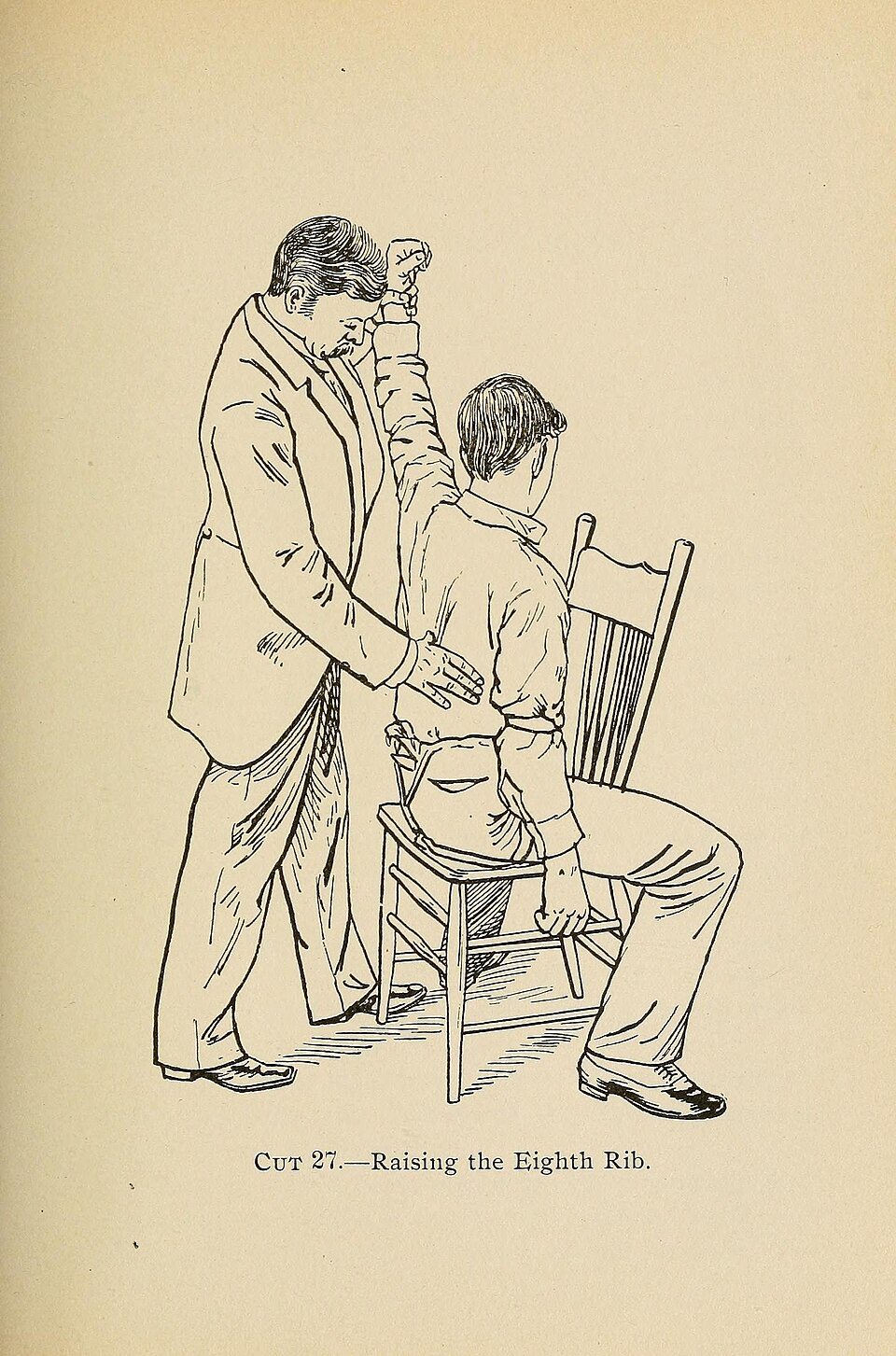 Gravure de 1898 : un homme debout derrière un patient assis sur une chaise lui tire le bras vers le haut en appuyant sur son dos. Légende : « Cut 27. Raising the Eighth Rib ».